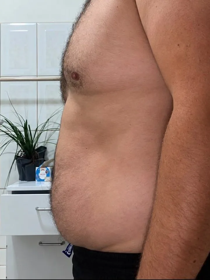 Transformação real de um cliente — antes